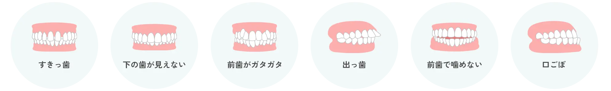 歯並び