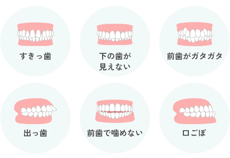歯並び