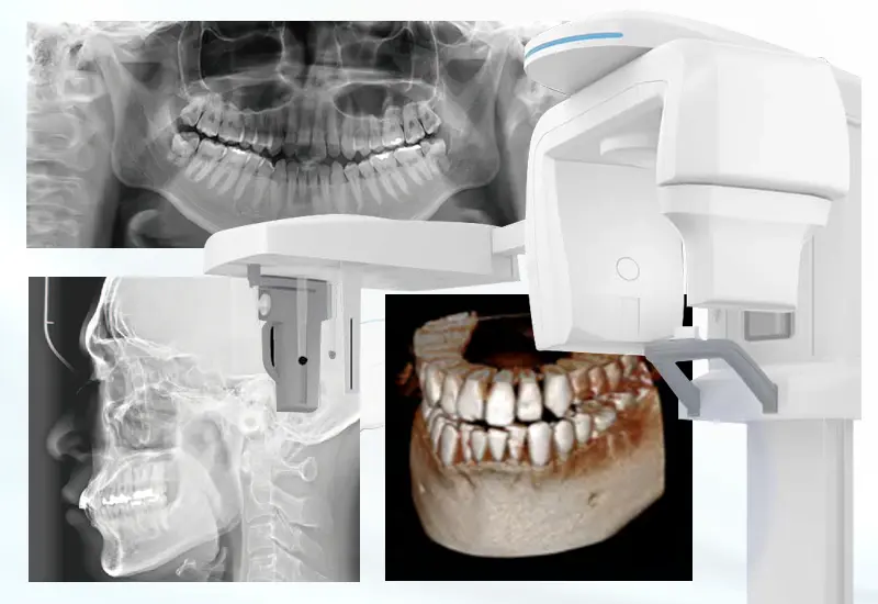 歯科用CT